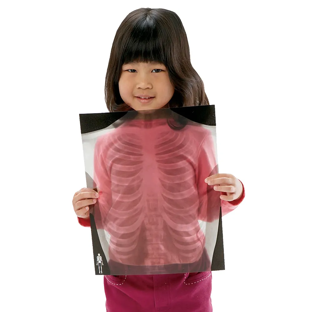 Human X-Rays